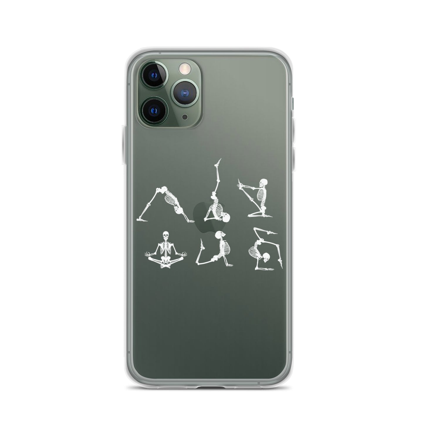 Skeletons doing yoga on a clear case for iPhone