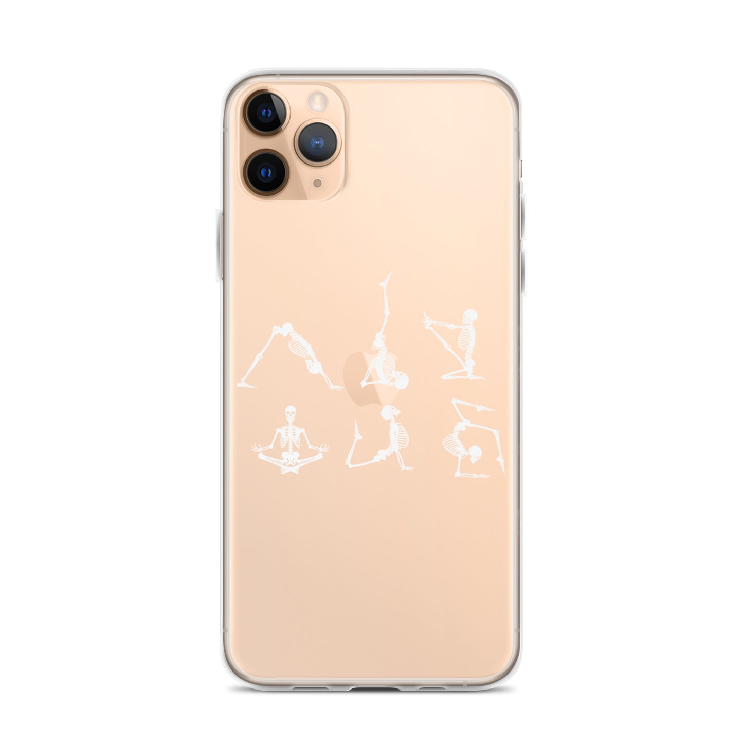 Skeletons doing yoga on a clear case for iPhone