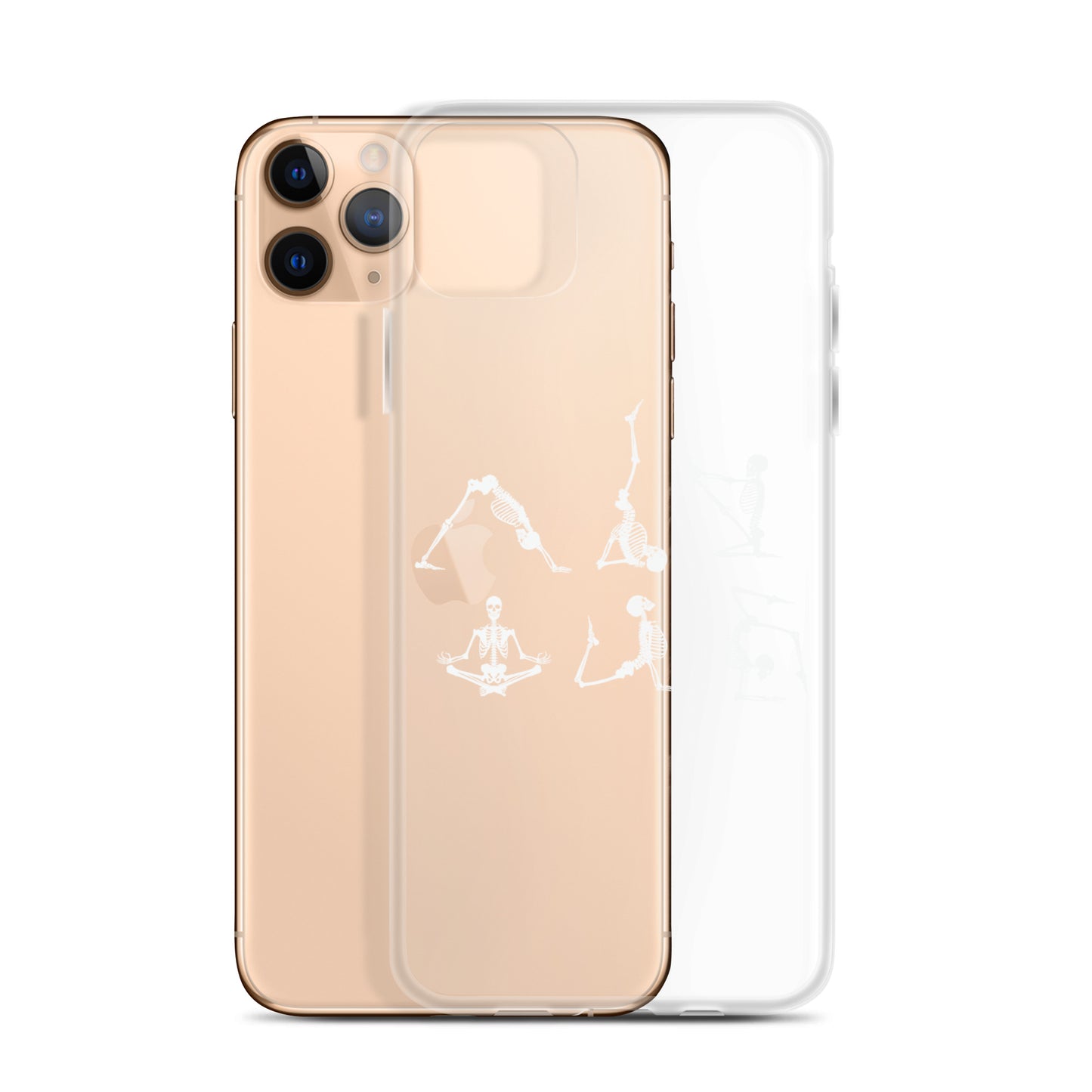 Skeletons doing yoga on a clear case for iPhone