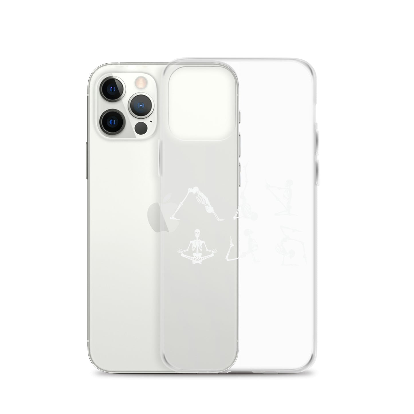 Skeletons doing yoga on a clear case for iPhone